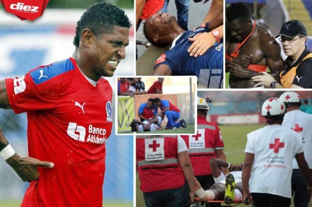 ¡Fracturas! Las graves lesiones que se han dado en el fútbol hondureño