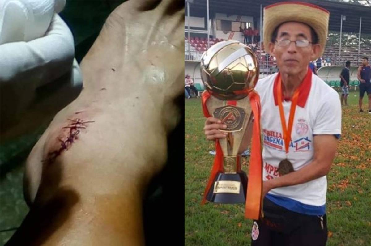 Agreden a Masaaki, aficionado japonés de la Real Sociedad en Tocoa