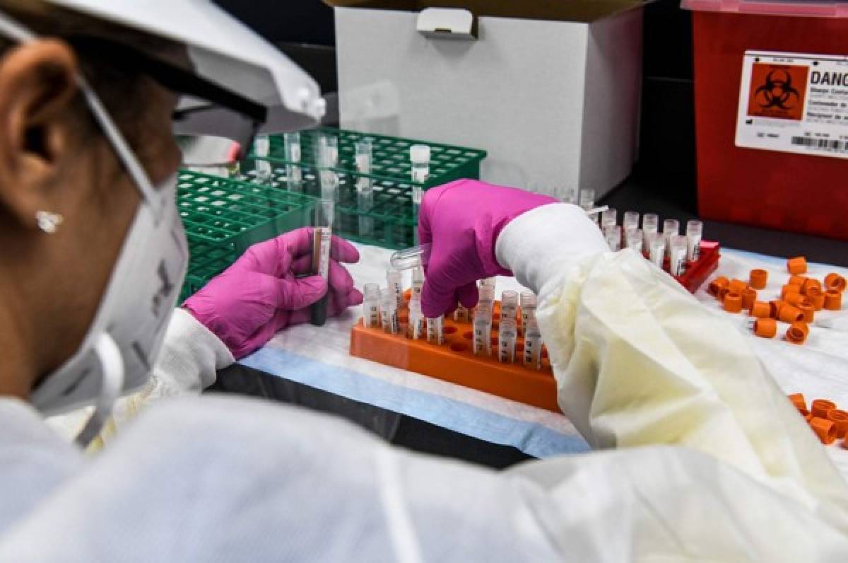 Cuba anuncia que comienza las pruebas de su propia vacuna para prevenir el coronavirus