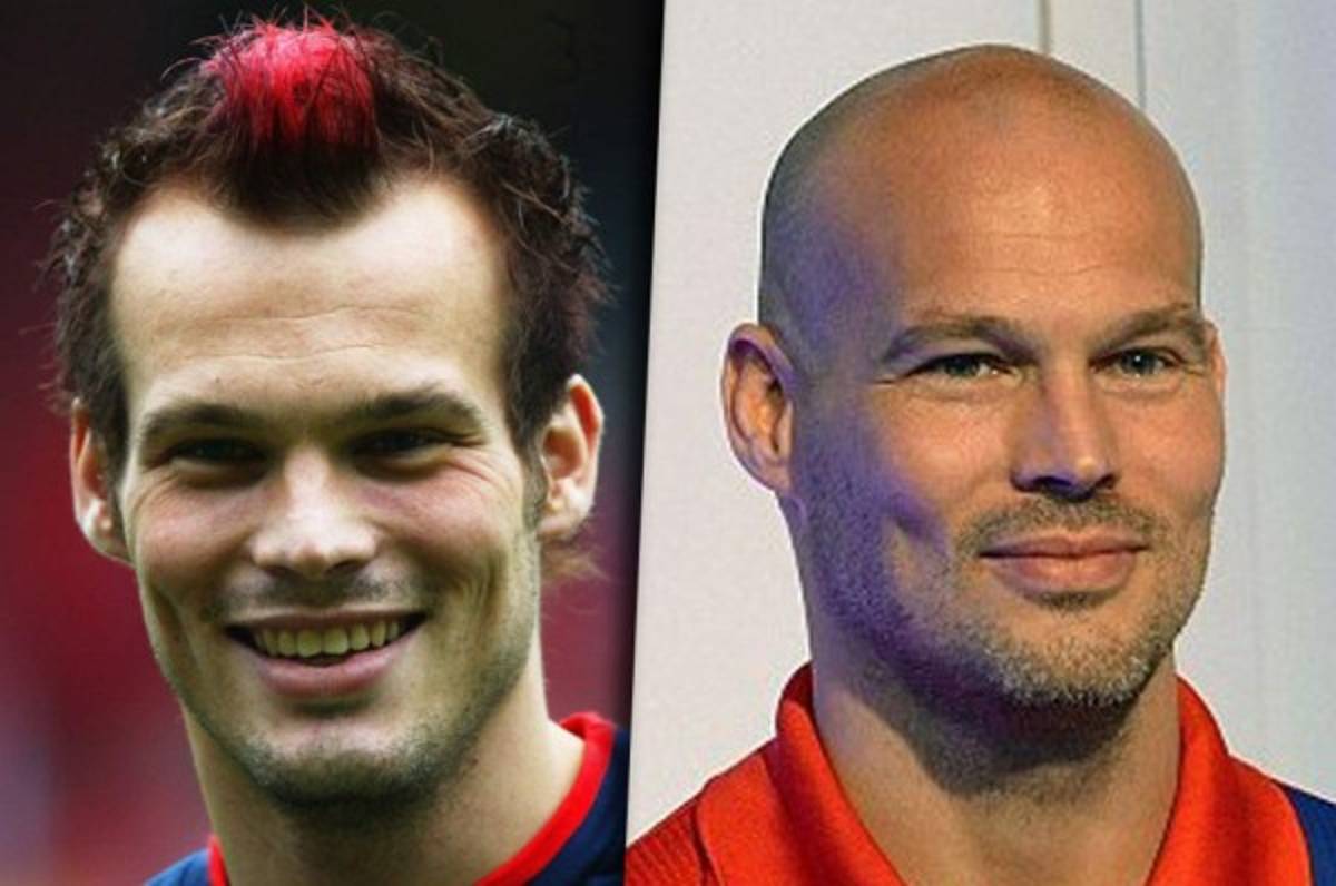 TOP 15: Los futbolistas que han quedado calvos a lo largo de su carrera