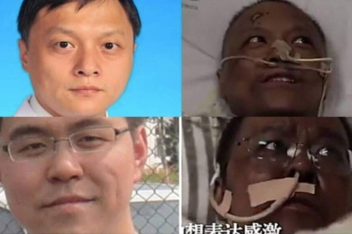 Muere uno de los médicos chinos cuya piel se volvió negra tras contagiarse de coronavirus