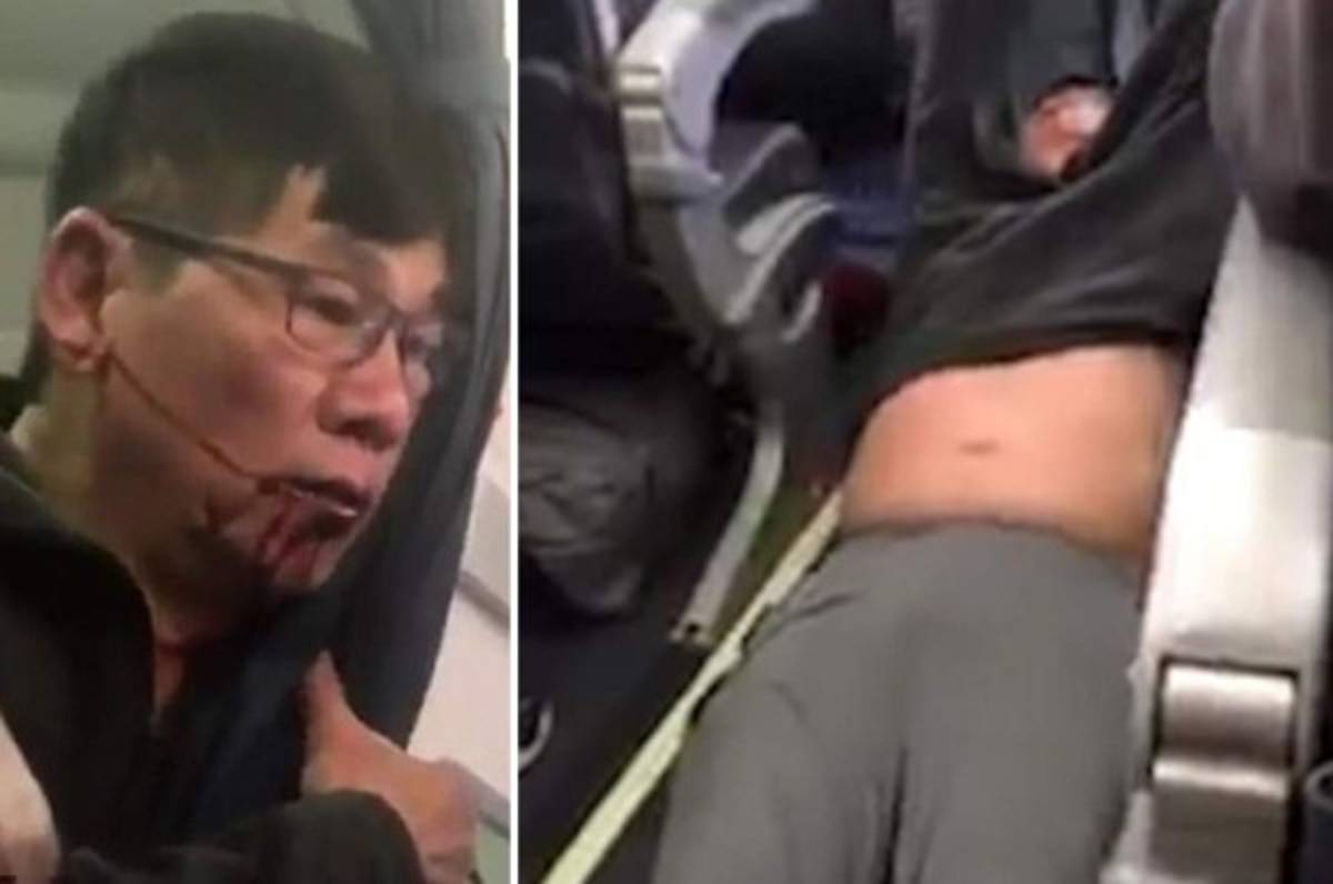 El oscuro pasado del doctor David Dao, pasajero expulsado de un avión de United