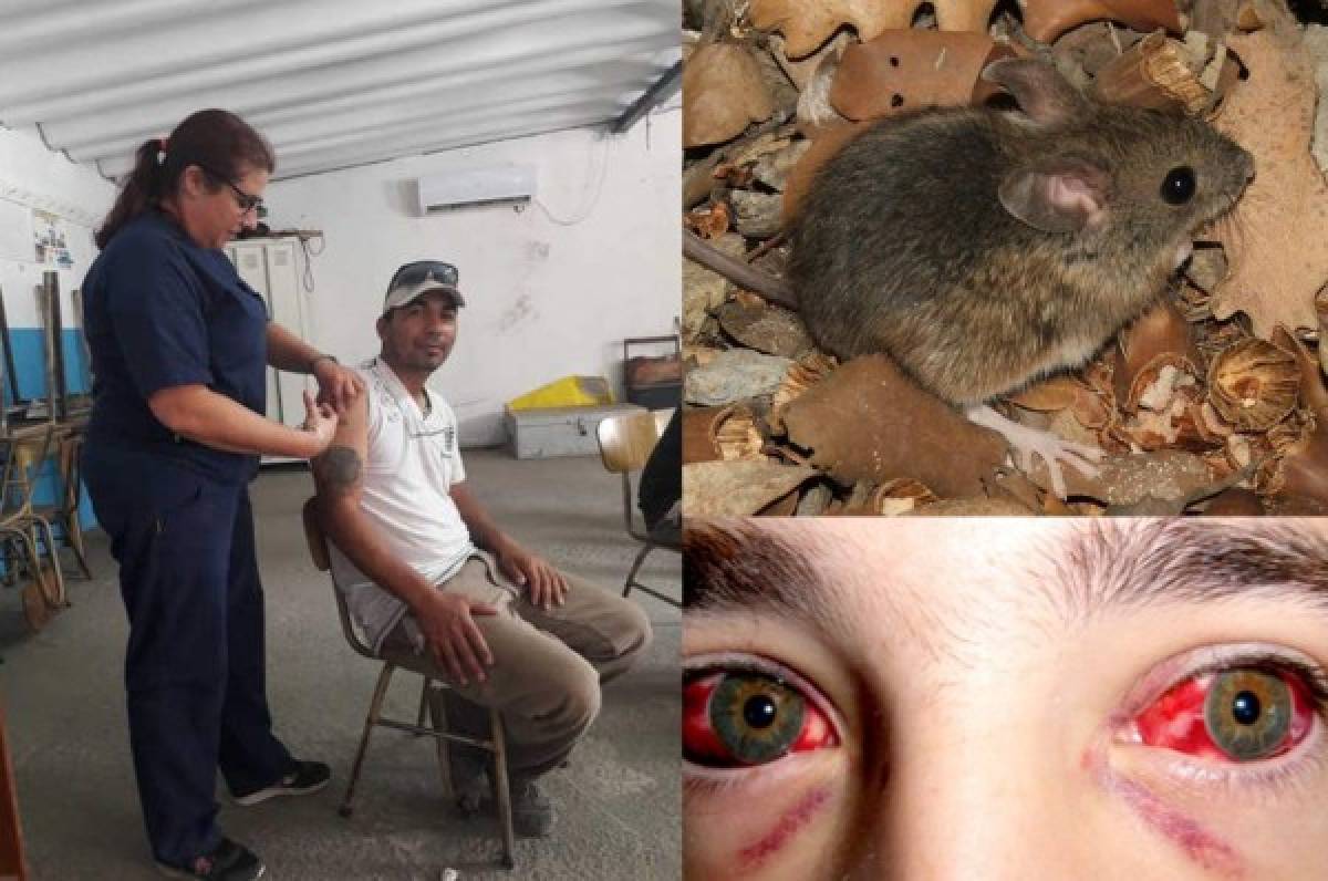 ¡Transmitidos por ratas, monos y aves! Estos son los 10 virus más letales en el mundo