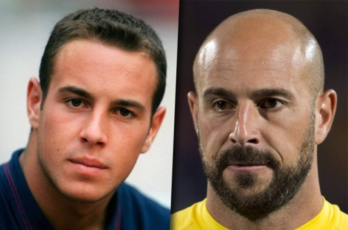 TOP 15: Los futbolistas que han quedado calvos a lo largo de su carrera