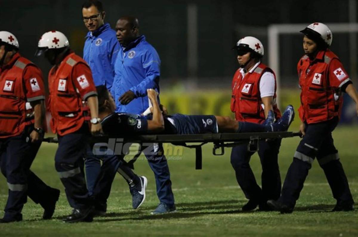 Juan Pablo Montes sufre lesión muscular y es duda para el juego ante Atlanta United