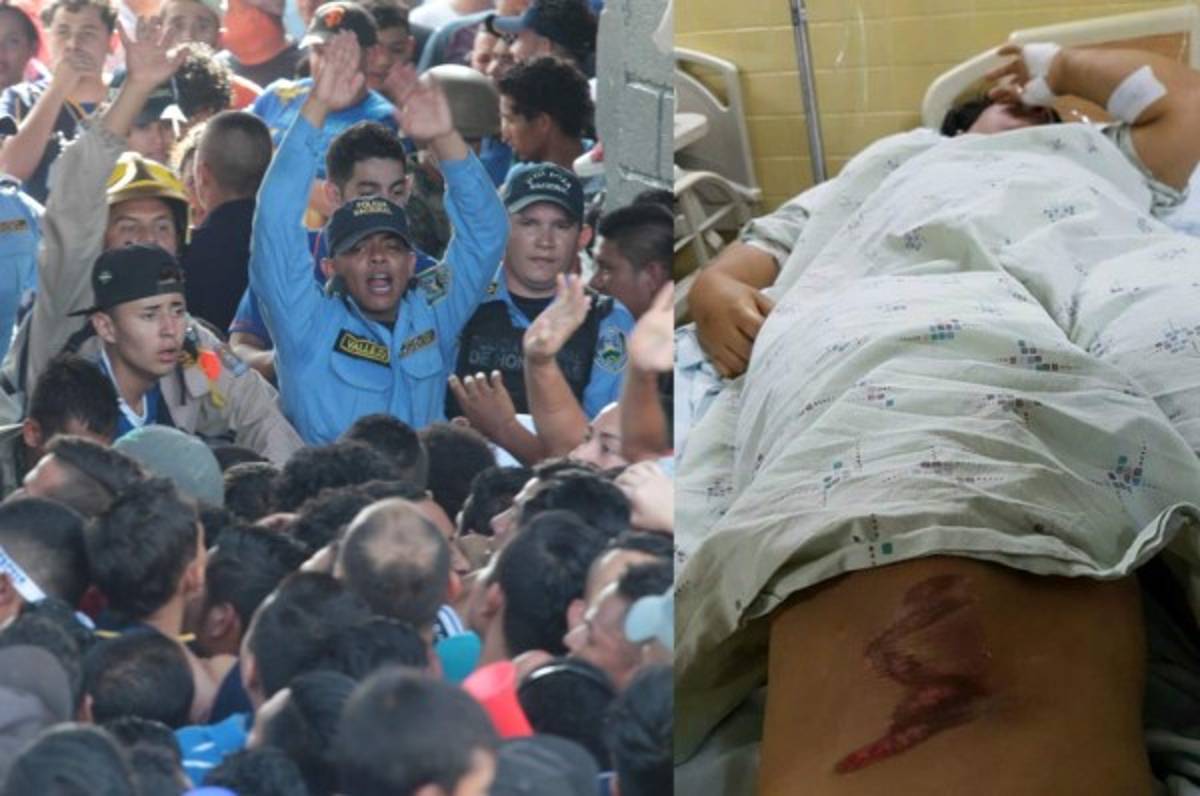 Impactante relato de sobreviviente en la tragedia del Nacional: 'Yo estaba muerta'