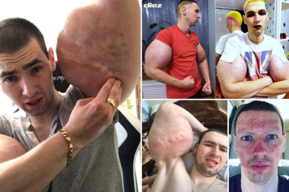 La terrible pesadilla que vivió el 'Popeye' ruso: ''Estaba tirado sintiendo que me moría''