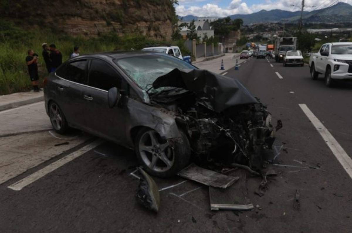 Así quedó el automóvil de Mayron Flores, jugador del Olimpia, tras sufrir accidente de tránsito