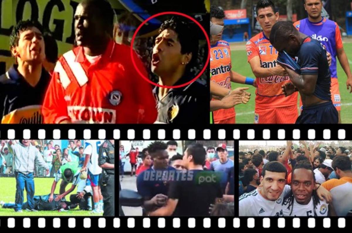 Baño de aceite quemado, uno apaleado y otro apedreado: futbolistas hondureños que fueron agredidos en el extranjero