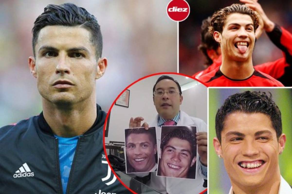 Cristiano Ronaldo: Desvelan las cinco cirugías que se realizó para cambiar su imagen