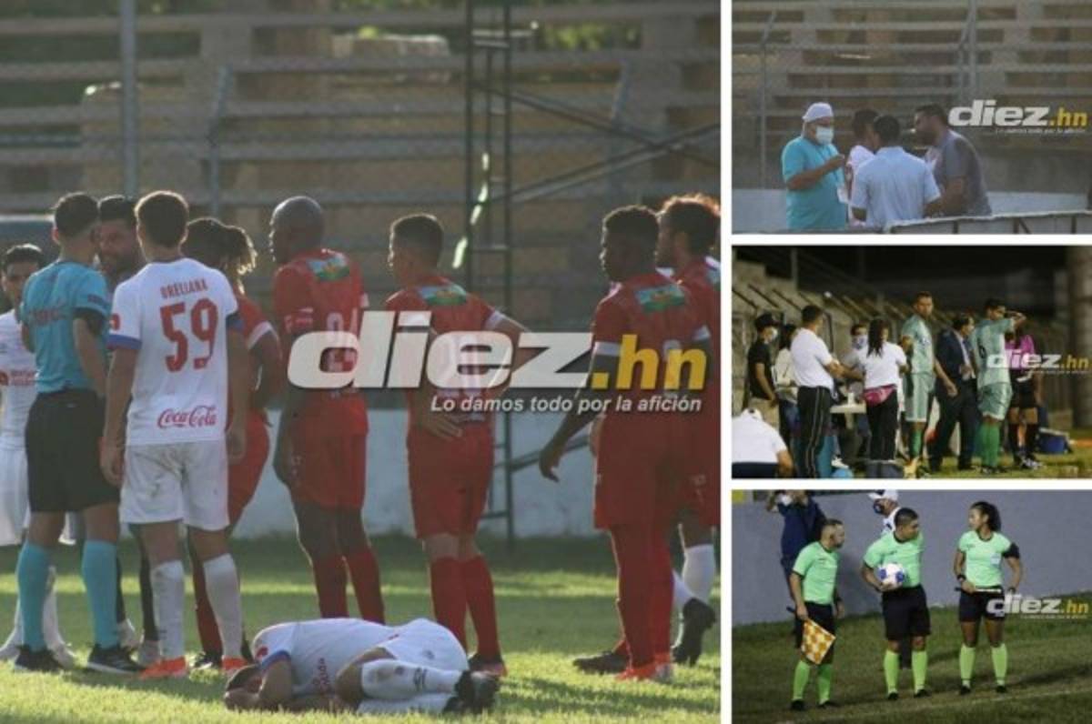 Fotos: La bronca de Obed con Carlos Pineda y el portero del Real de Minas que jugó de delantero