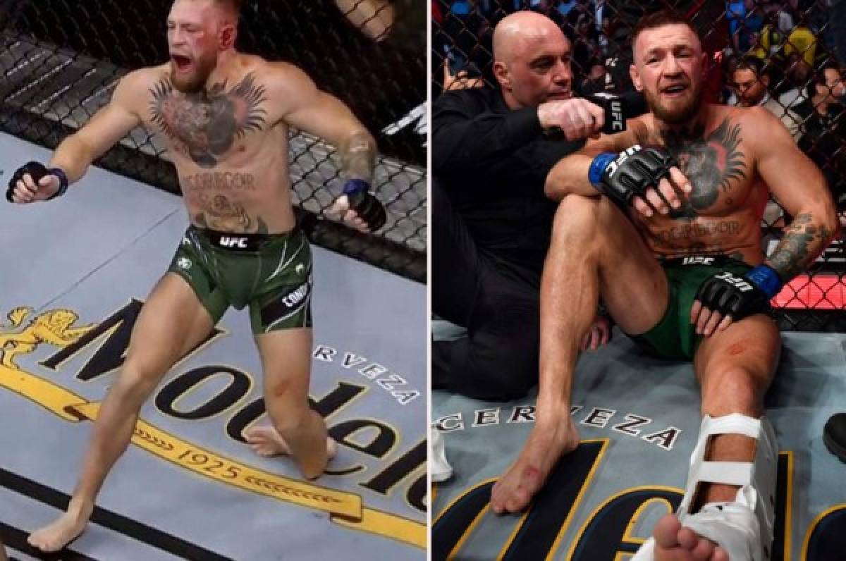 UFC: revelan la enfermedad que sufre Conor McGregor y que fue la causa de su terrible fractura