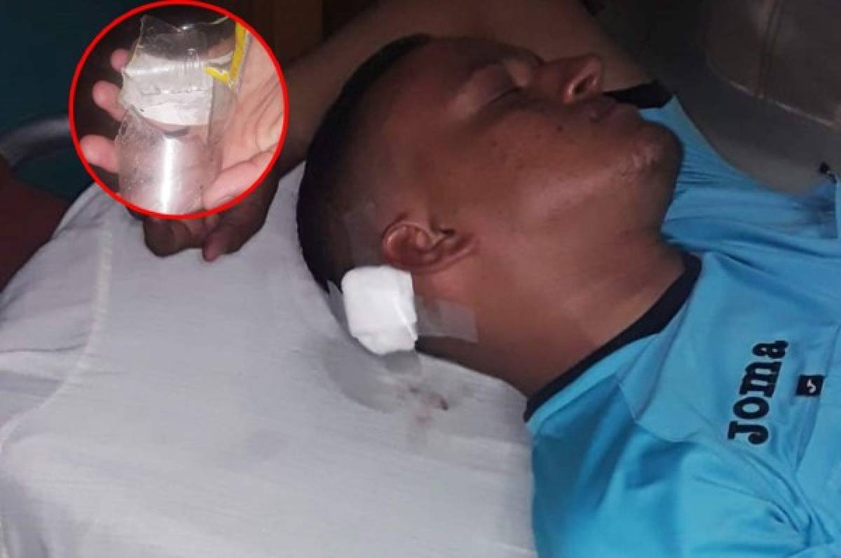 Árbitro es agredido con un botellazo en partido de la Liga de Ascenso de Honduras