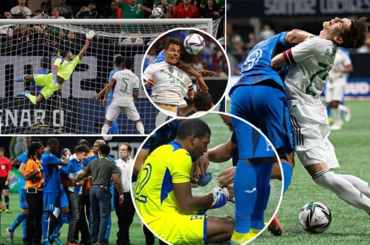 Patadas, agarrones y el espontáneo defendido por futbolistas: Las mejores fotos del Honduras-México en Atlanta