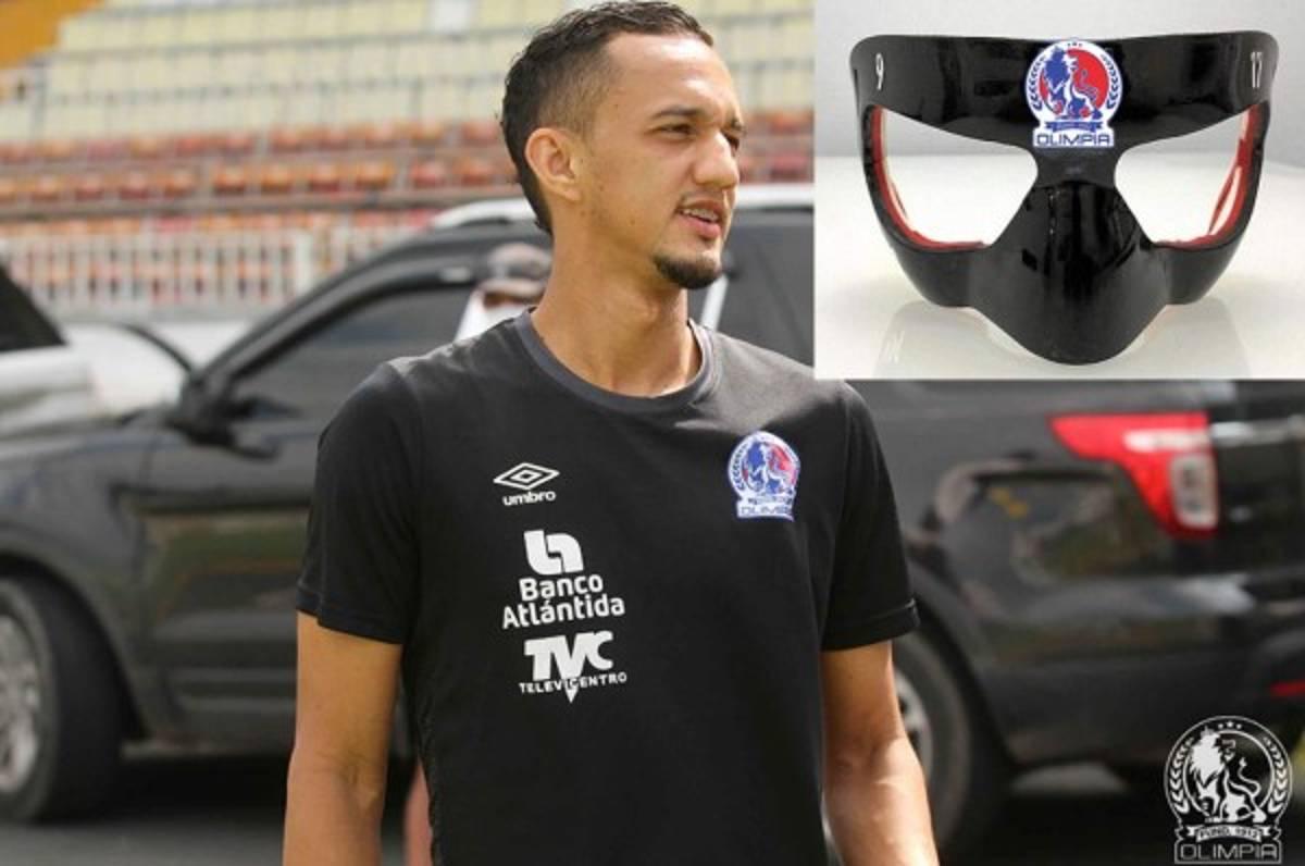 El delantero del Olimpia, Diego Reyes, será operado de su nariz y se pierde lo que resta del torneo