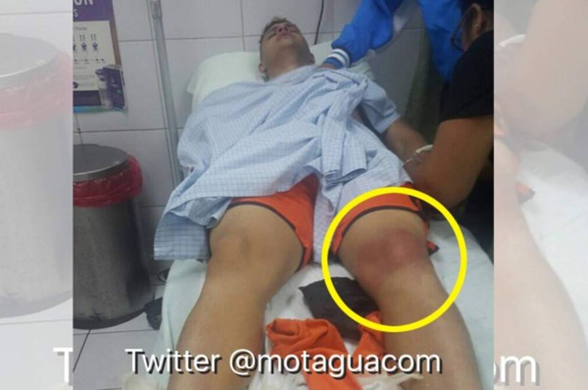 Así quedó rodilla de Harold Fonseca tras choque con Luis Castro
