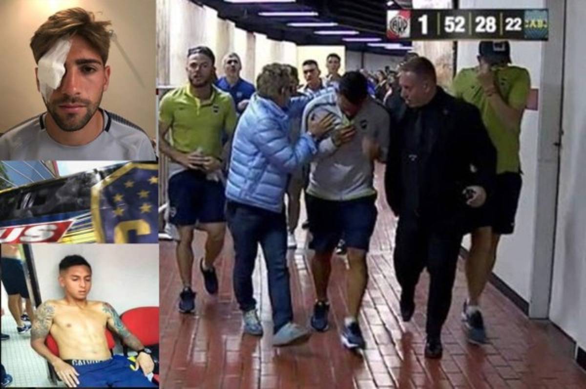 River-Boca: Lo que dice el reglamento de la Libertadores en caso de que se suspenda la final