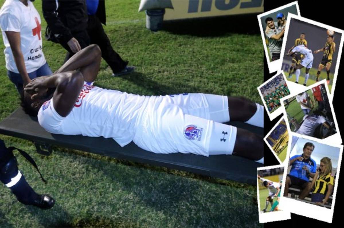 Las imágenes que la televisión no mostró de la jornada 17 en Honduras