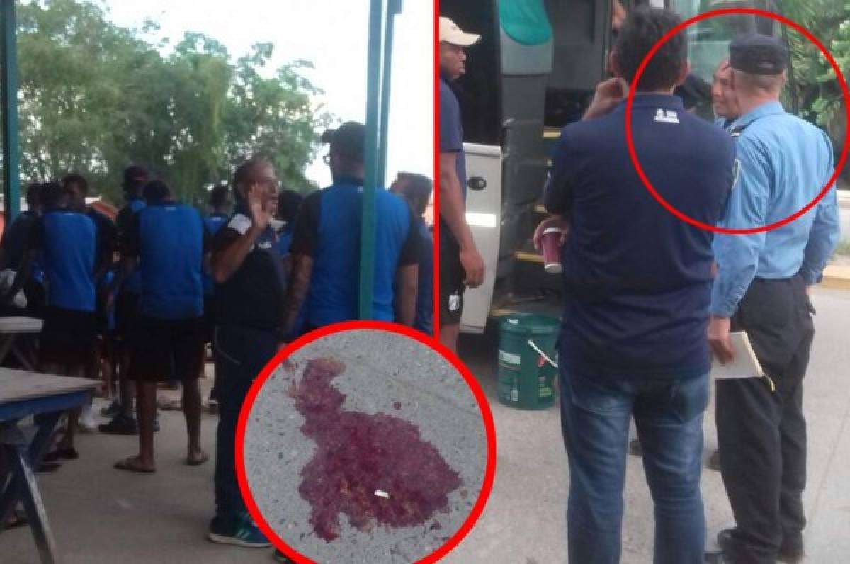 Autobús que traslada al Honduras Progreso atropella a ciclista