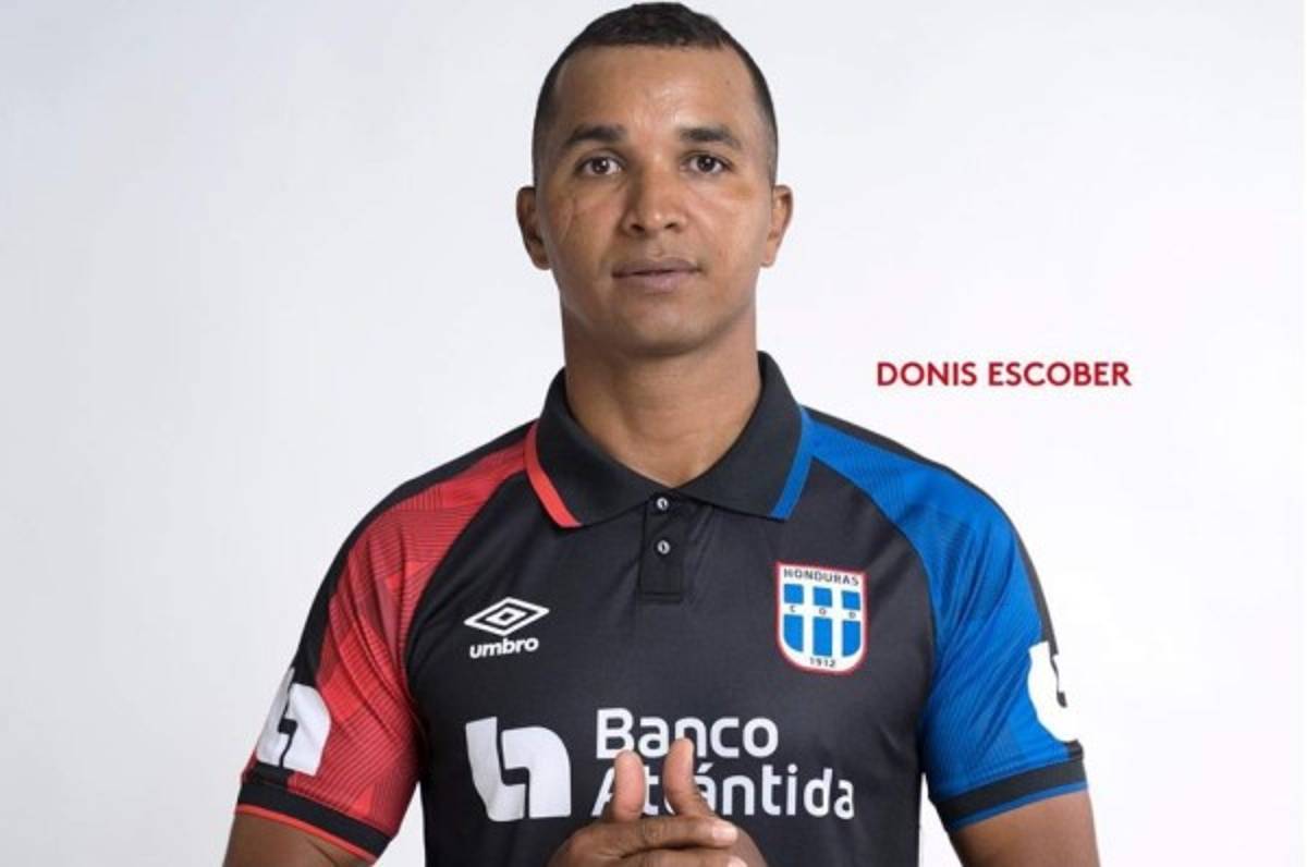 La extraña 'deformación' que sufrió Donis Escober en su dedo tras su retiro: Así se vio en la foto que Olimpia publicó