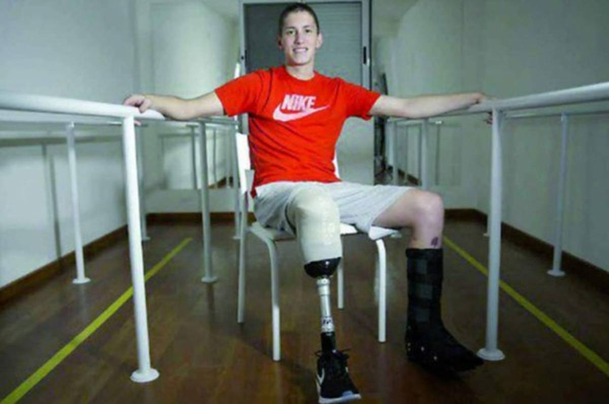 Jackson Follmann ya dio sus primeros pasos con su nueva prótesis