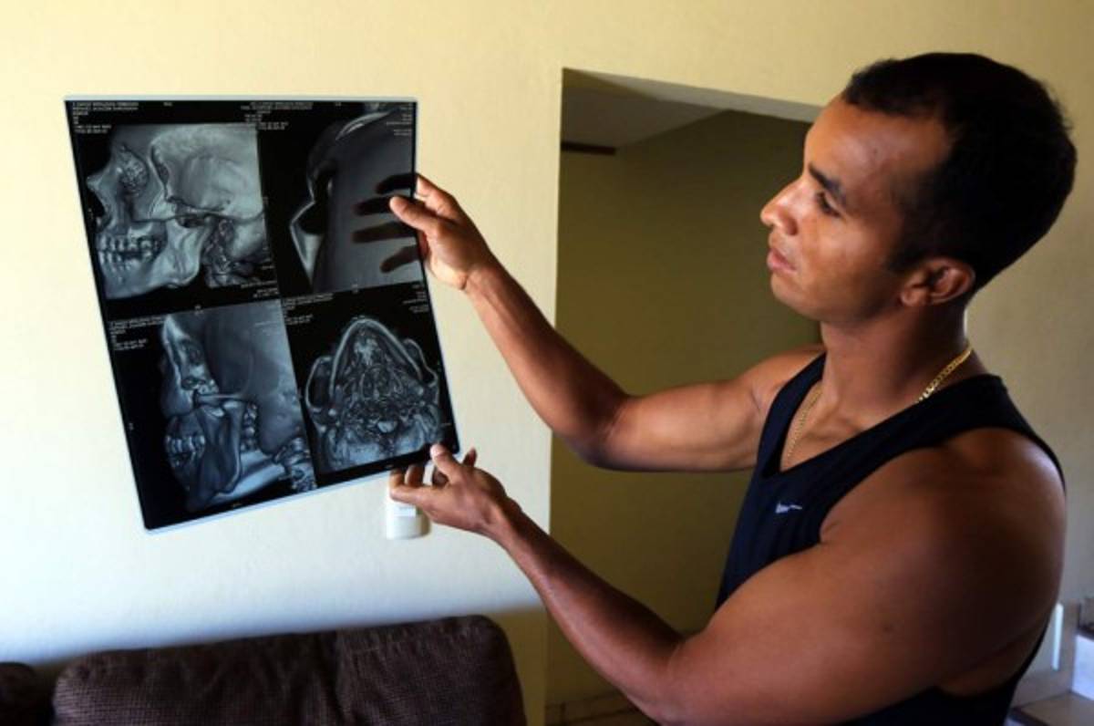 Donis Escober: 'Pensé que iba a perder el conocimiento”