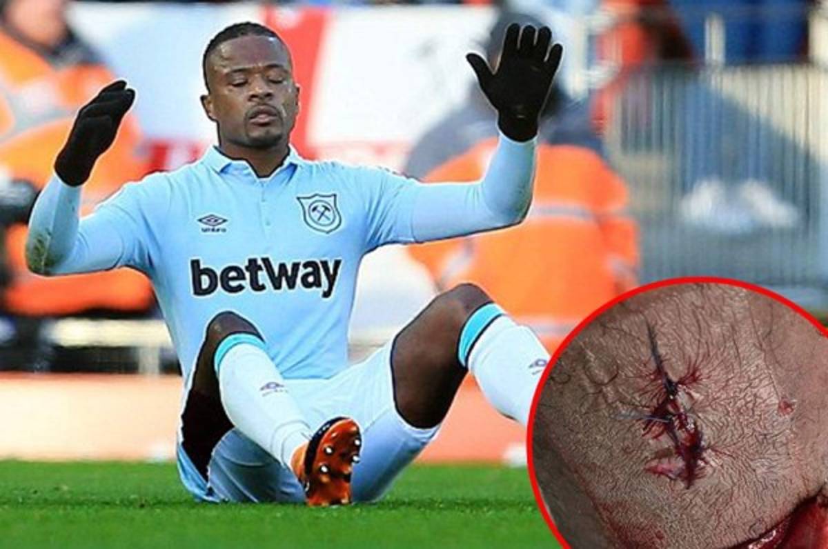 No apto para sensibles: La escalofriante herida que sufrió Evra en la Premier League