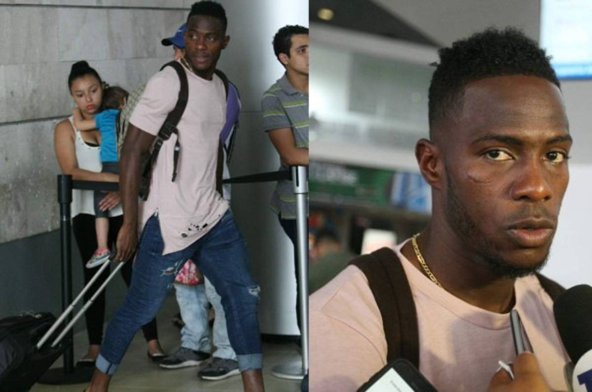 Maynor Figueroa avisa previo a los partidos: 'Estamos al límite'