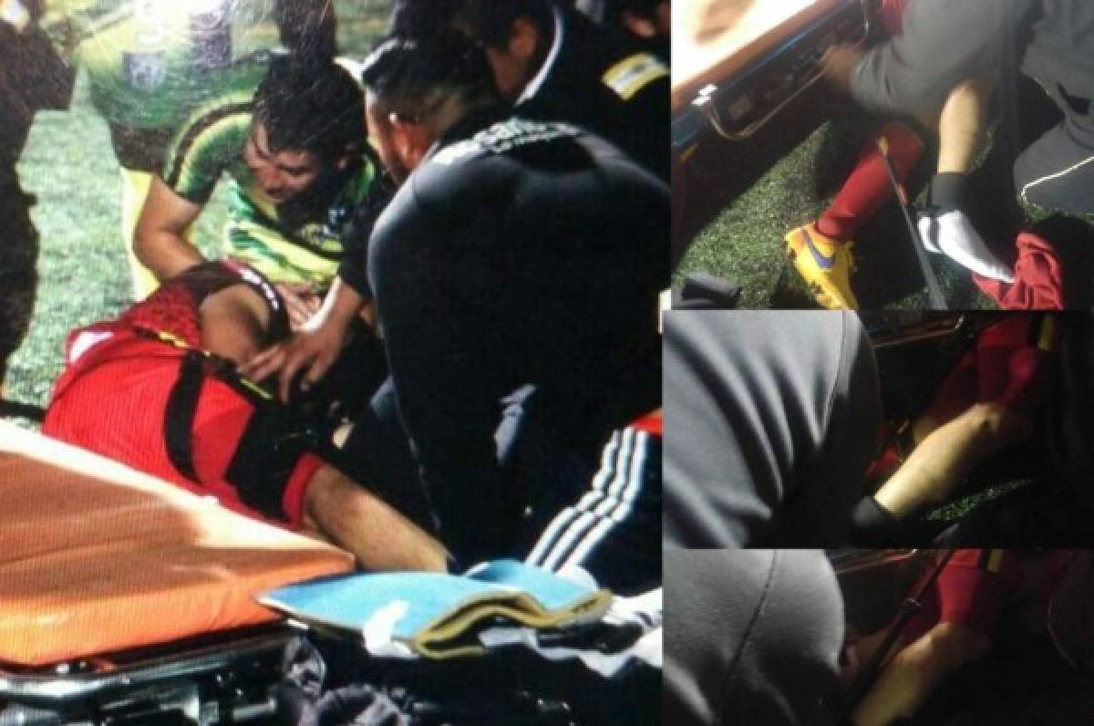 Exjugador de Marathón, Israel Silva, sufrió terrible lesión en Guatemala