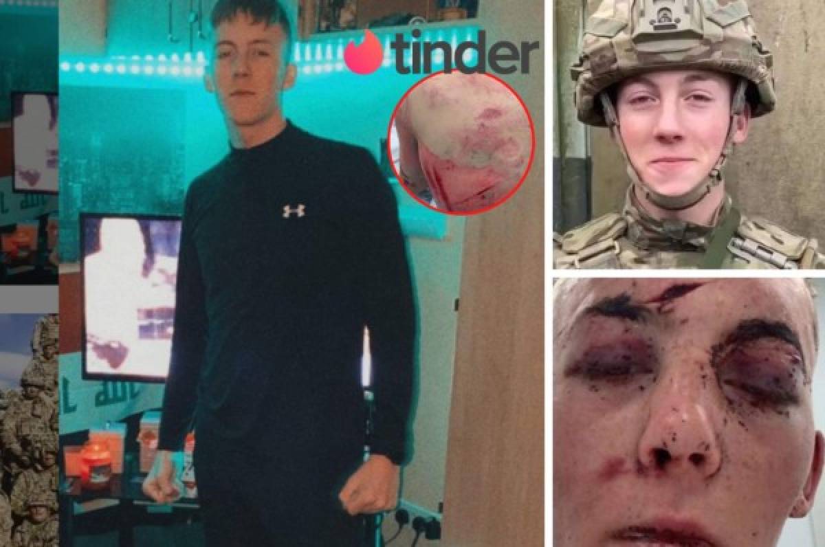 Cara desfigurada y huesos rotos: La paliza que le dieron a un soldado tras ser secuestrado en una cita de Tinder