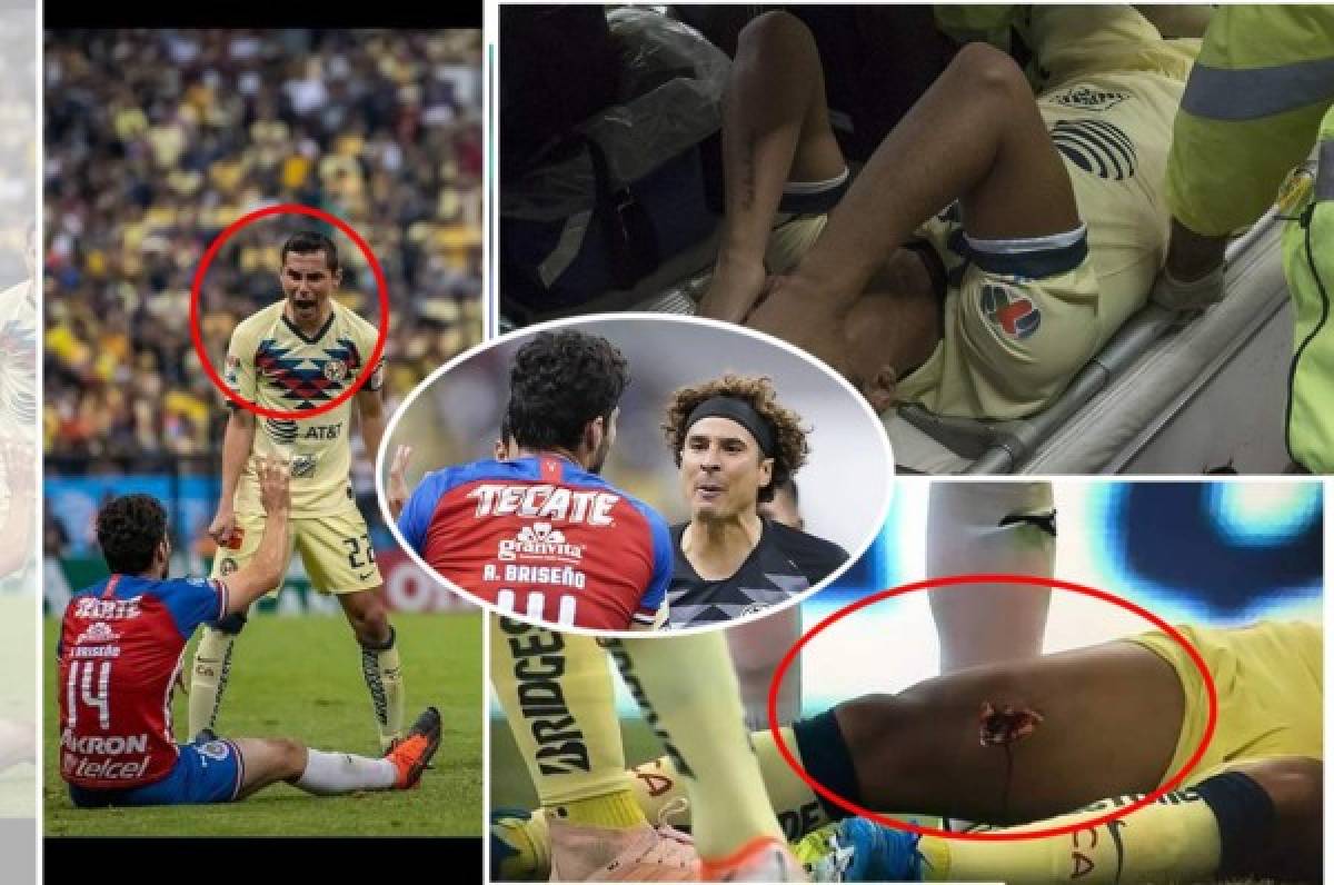 Las impactantes y terroríficas imágenes de la grave lesión de Giovanni dos Santos