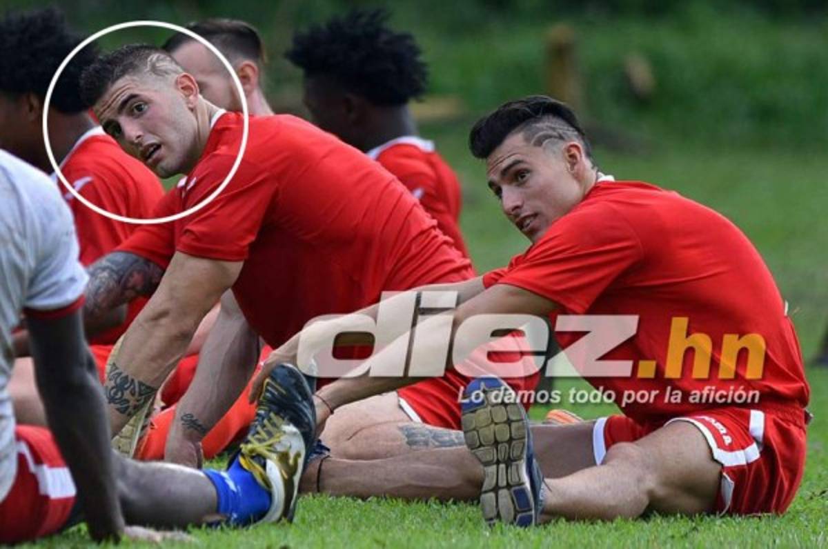 ¡Increíble! Kevin Hoyos se lesiona sin jugar en el Vida