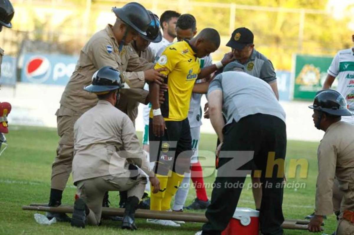 Rony Martínez será operado y estará tres semanas de baja en Real España