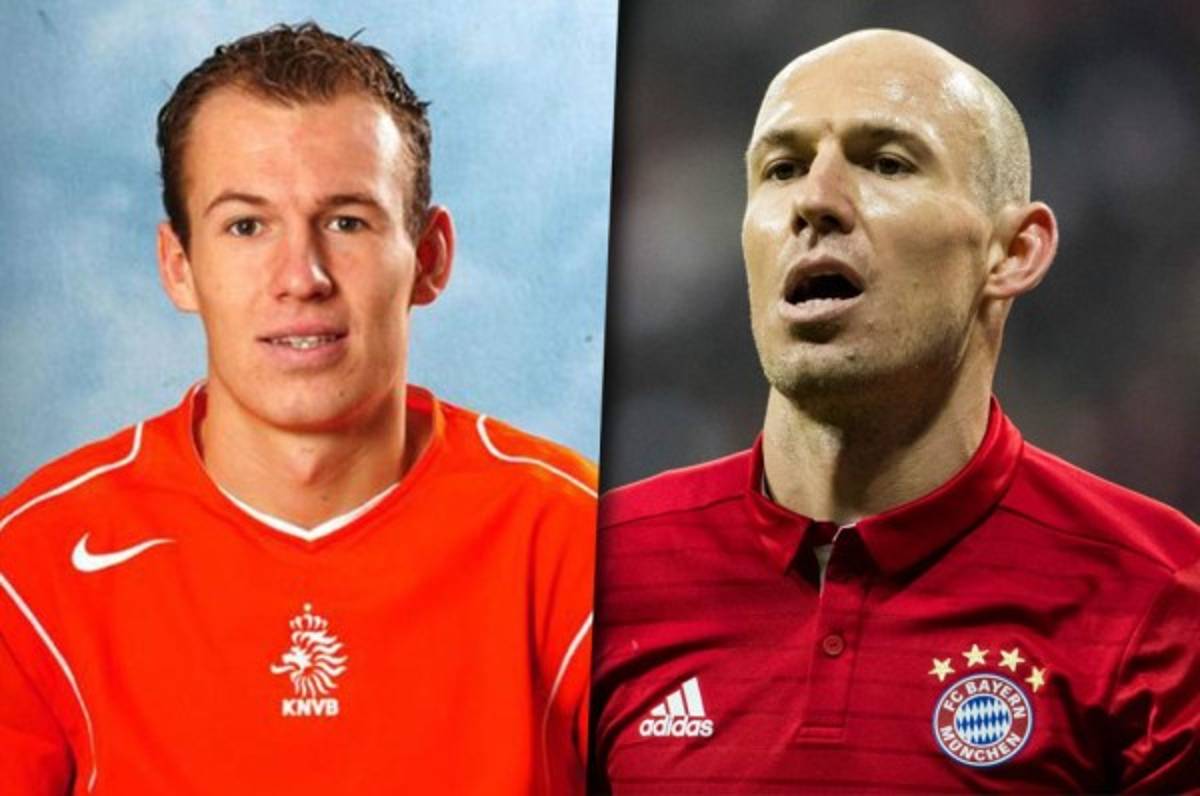 TOP 15: Los futbolistas que han quedado calvos a lo largo de su carrera