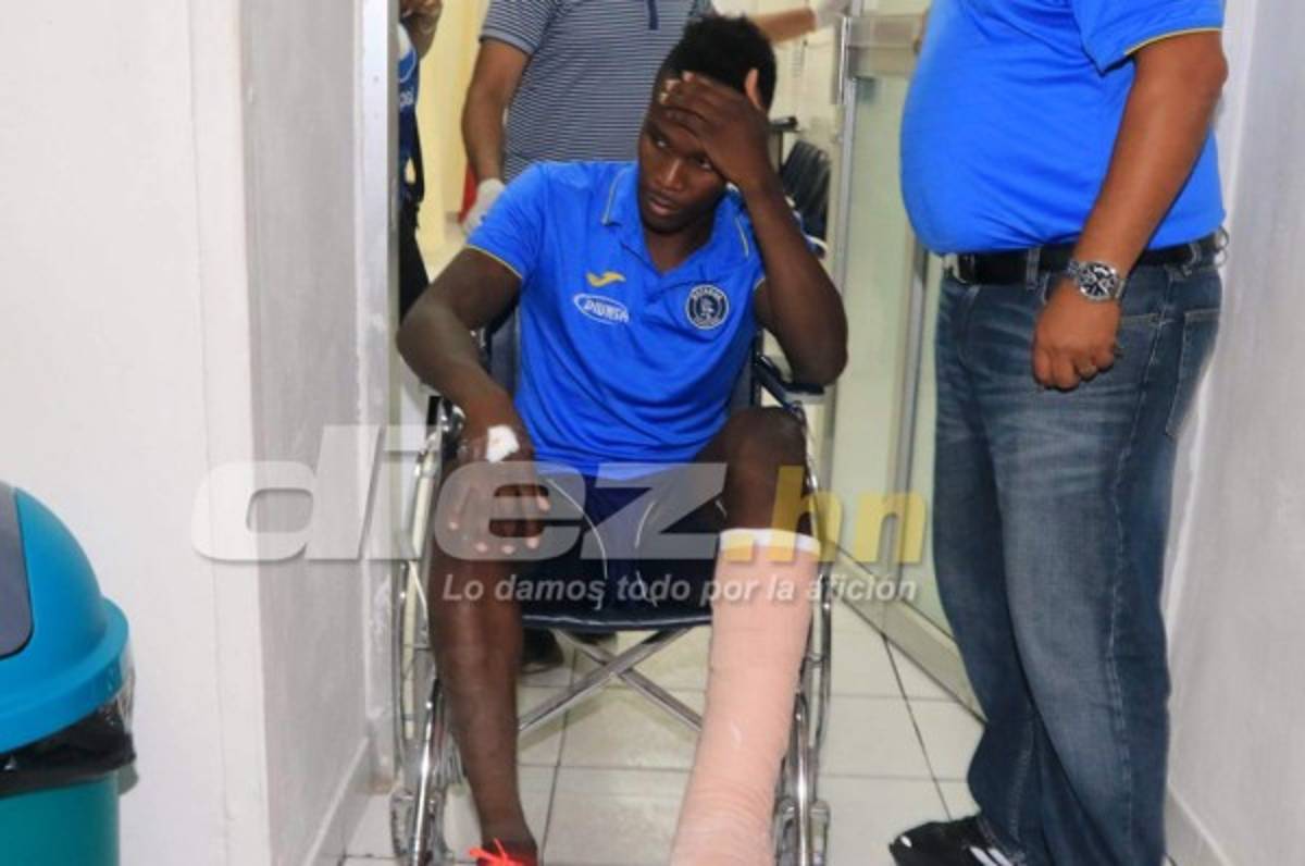 Se terminó el torneo para Rubilio: 'Solo me queda pensar en el próximo campeonato'