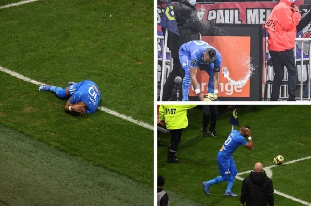 Fotos: Así fue la agresión que sufrió Payet en la Liga de Francia; ¡botellazo en la cabeza!