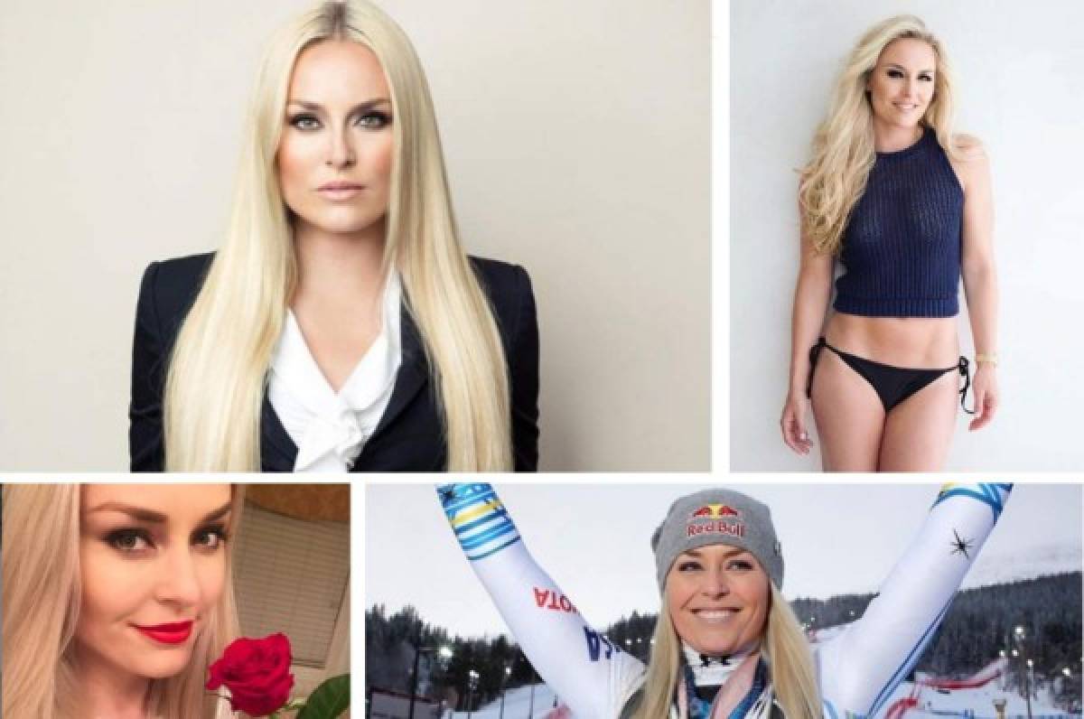 Así luce Lindsey Vonn , la ganadora del Premio Princesa de los Deportes de Asturias