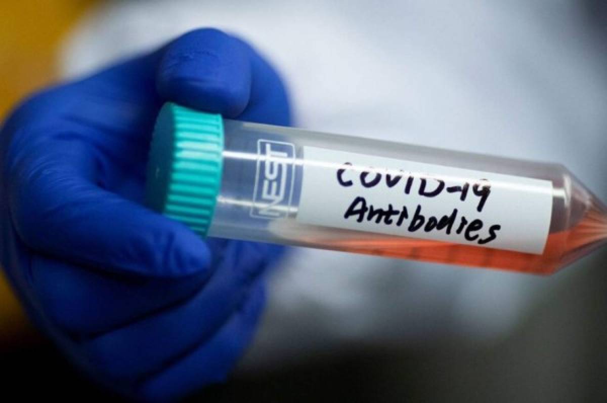 Un anticuerpo encontrado en sobreviviente del SARS reveló el punto débil del coronavirus