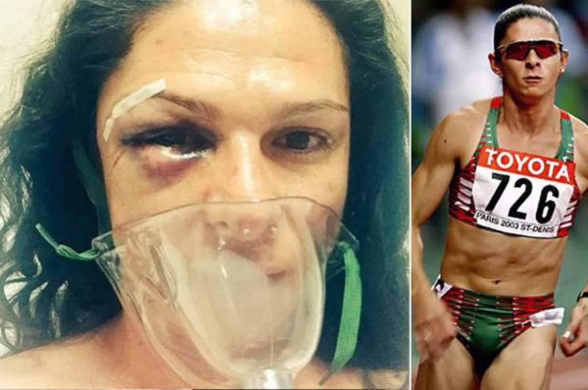 Golpean salvajemente a ex atleta de México Ana Gabriela Guevara