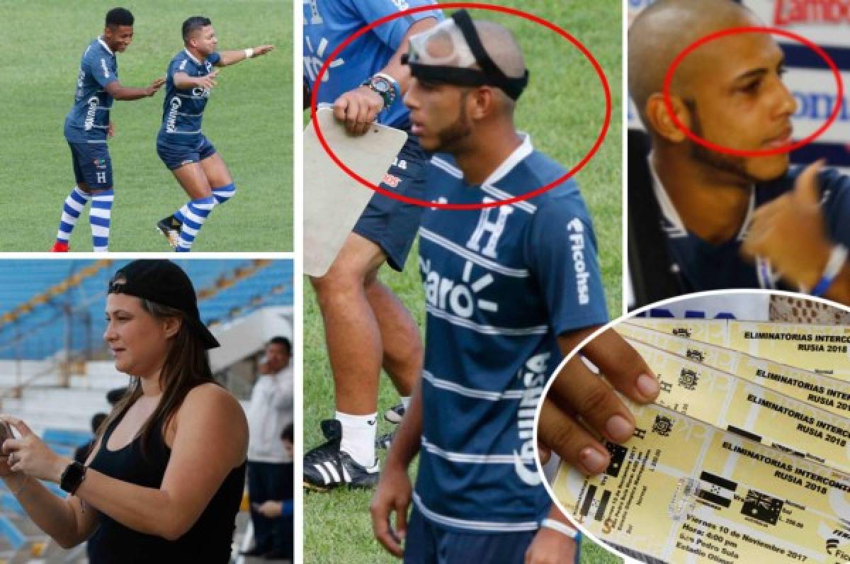 ¡Ufff! Eddie Hernández se quita la máscara y así se ve su ojo; ambiente en Honduras se calienta