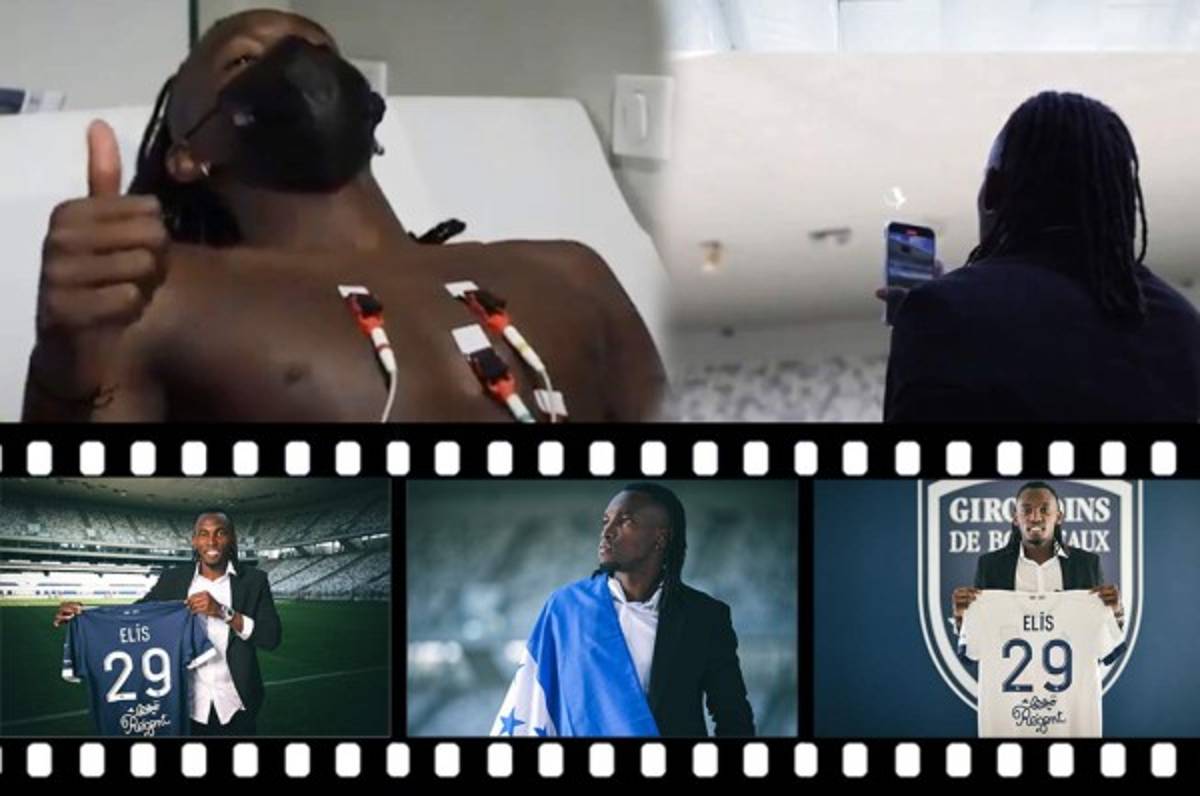 ¡Como artista de cine! La presentación de Alberth Elis y la firma de contrato en su primer día en el Girondins