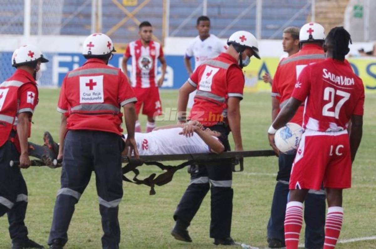 Olimpia es un hospital: los ocho jugadores que tendrá de baja para la final frente a Motagua