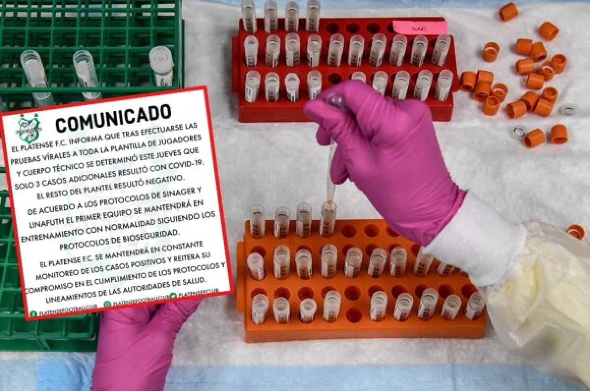 Platense, el tercer equipo en Honduras que admite de forma oficial que tiene casos de coronavirus