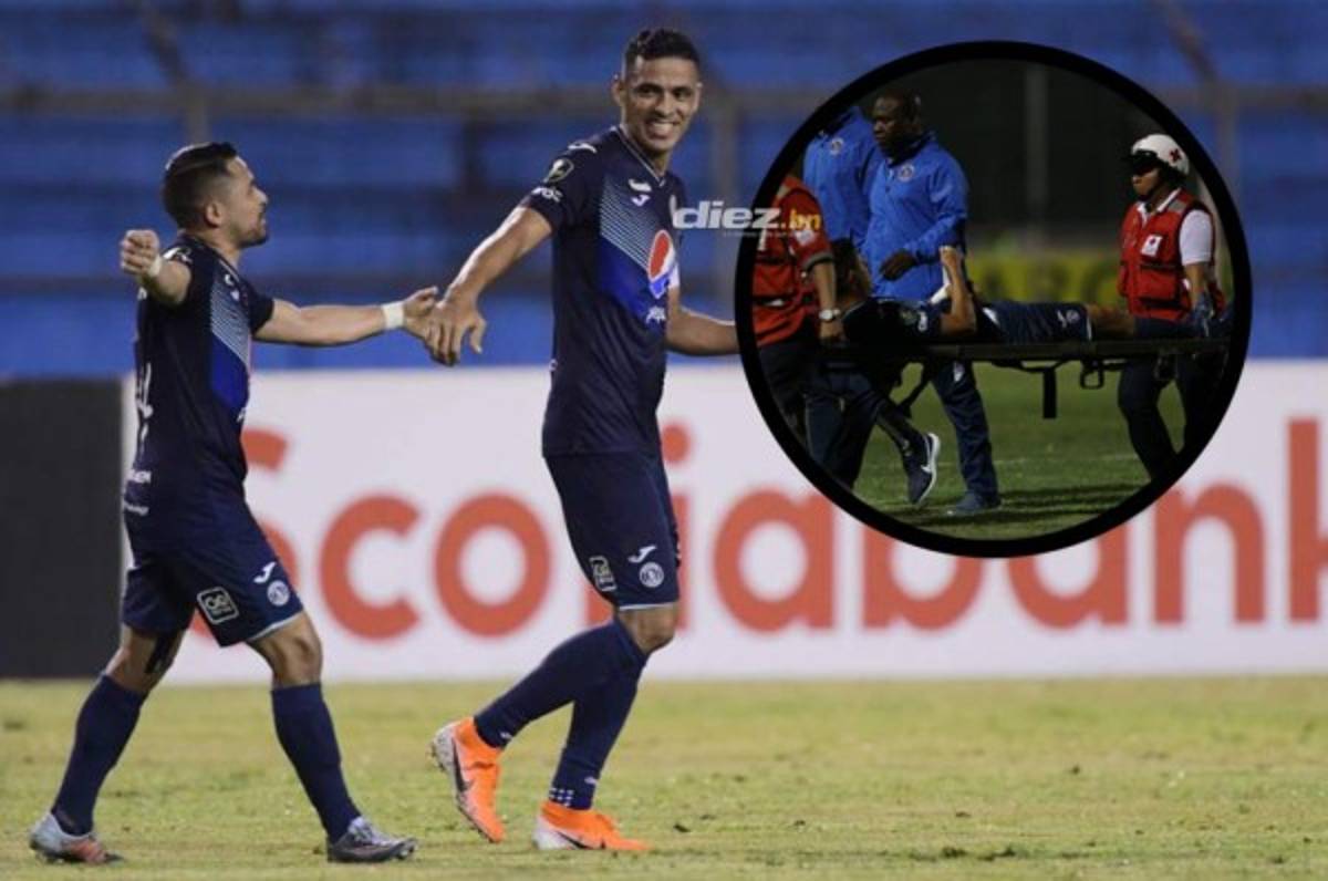 Juan Pablo Montes se pierde el juego ante Atlanta United por una lesión de 8-10 días