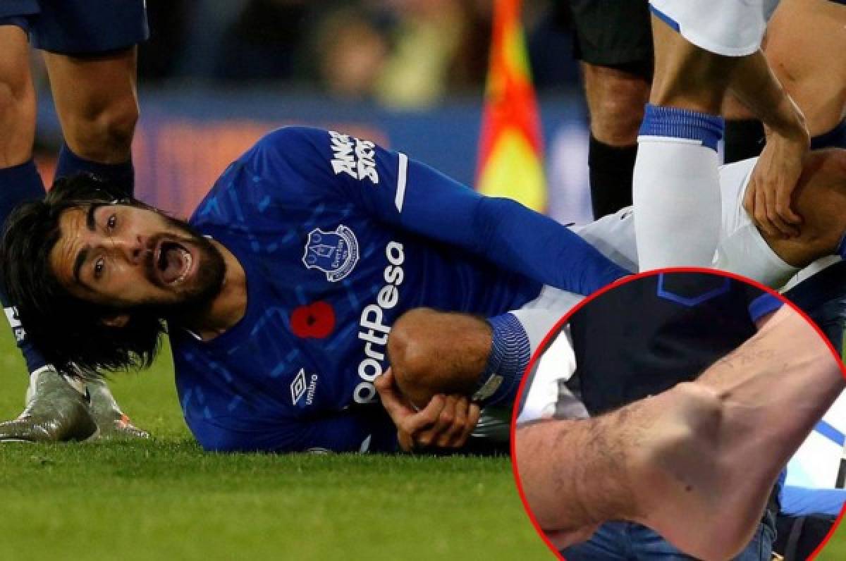 Así quedó el tobillo de André Gomes tras durísima lesión: ''Estamos devastados''