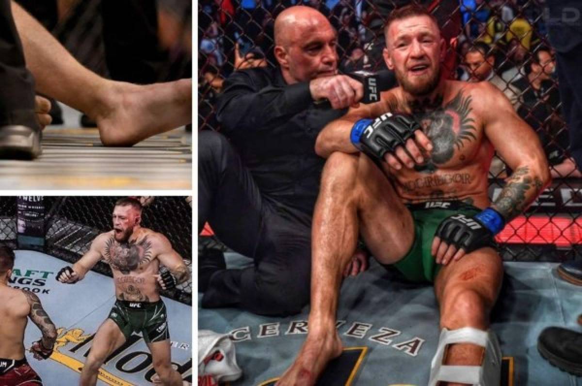 Espeluznantes imágenes: Así quedó la pierna de McGregor tras sufrir una fractura en la UFC