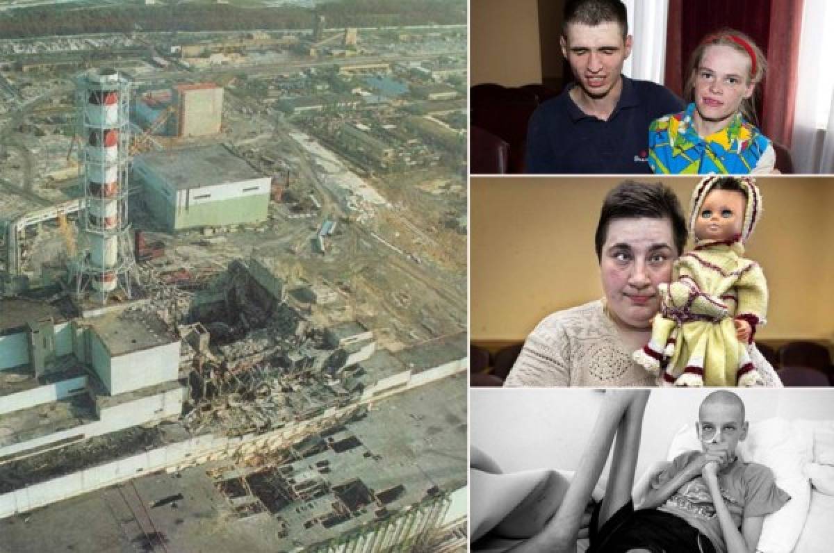 Impactantes fotos: los rostros de los sobrevivientes a la explosión de la planta nuclear de Chernobyl