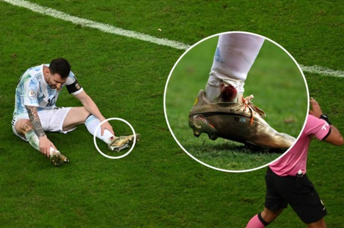 Messi salió sangrando en el Argentina-Colombia, pero ¿estará en la final ante Brasil?