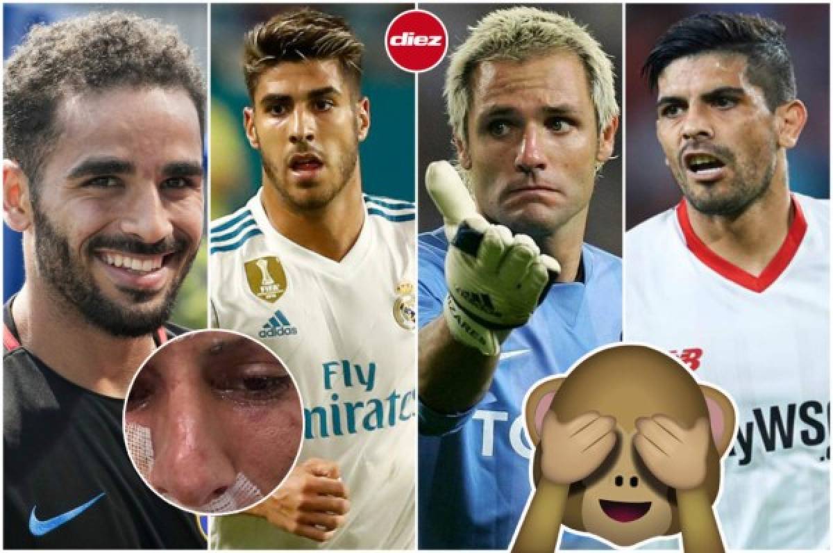 INCREÍBLE: Las 11 lesiones más disparatadas que han sufrido algunos futbolistas