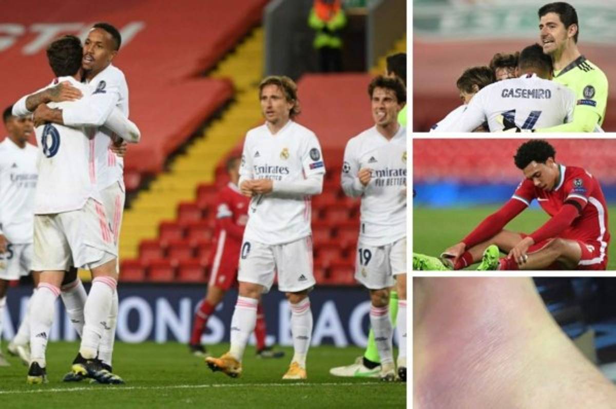 Lo que no se vio: La impactante foto del tobillo de Valverde y el festejo del Real Madrid en Anfield